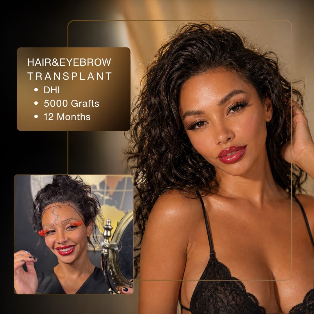 Before & After - DHI 5,000 Grafts